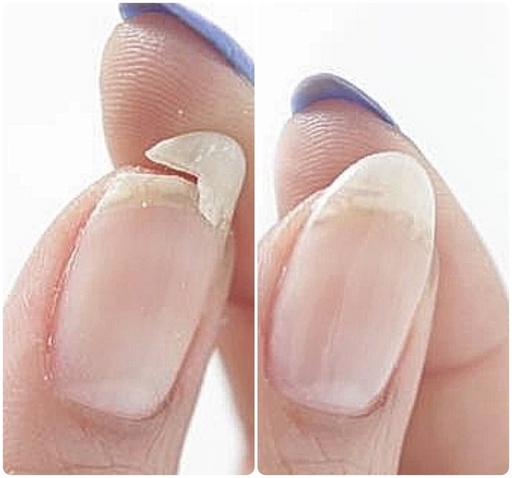 Repair 1 nail 5-10euro
